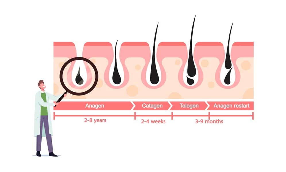 Hair Growth Cycle After Hair Transplant Surgery Month by Month