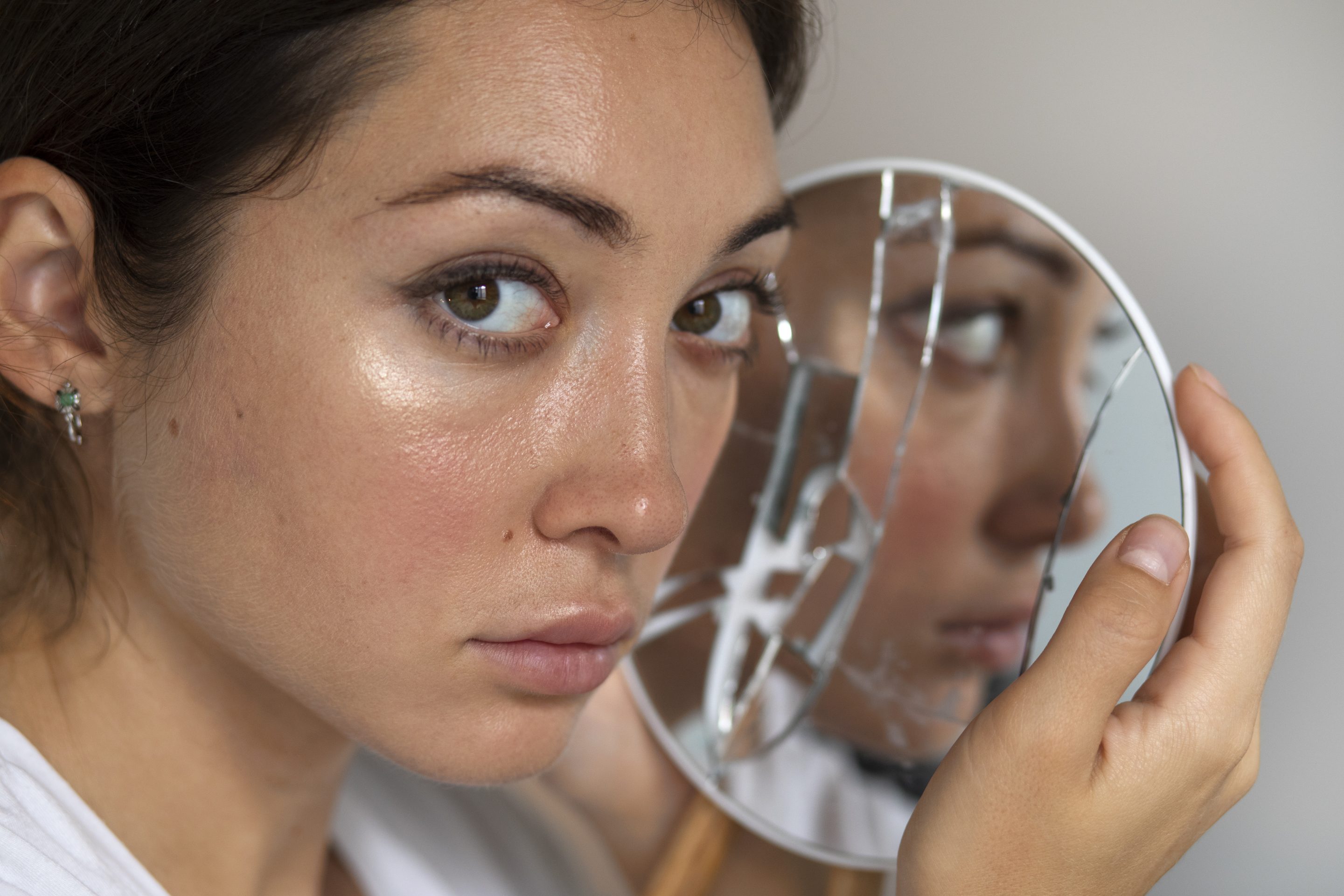 Best Treatment for Pigmentation in Delhi