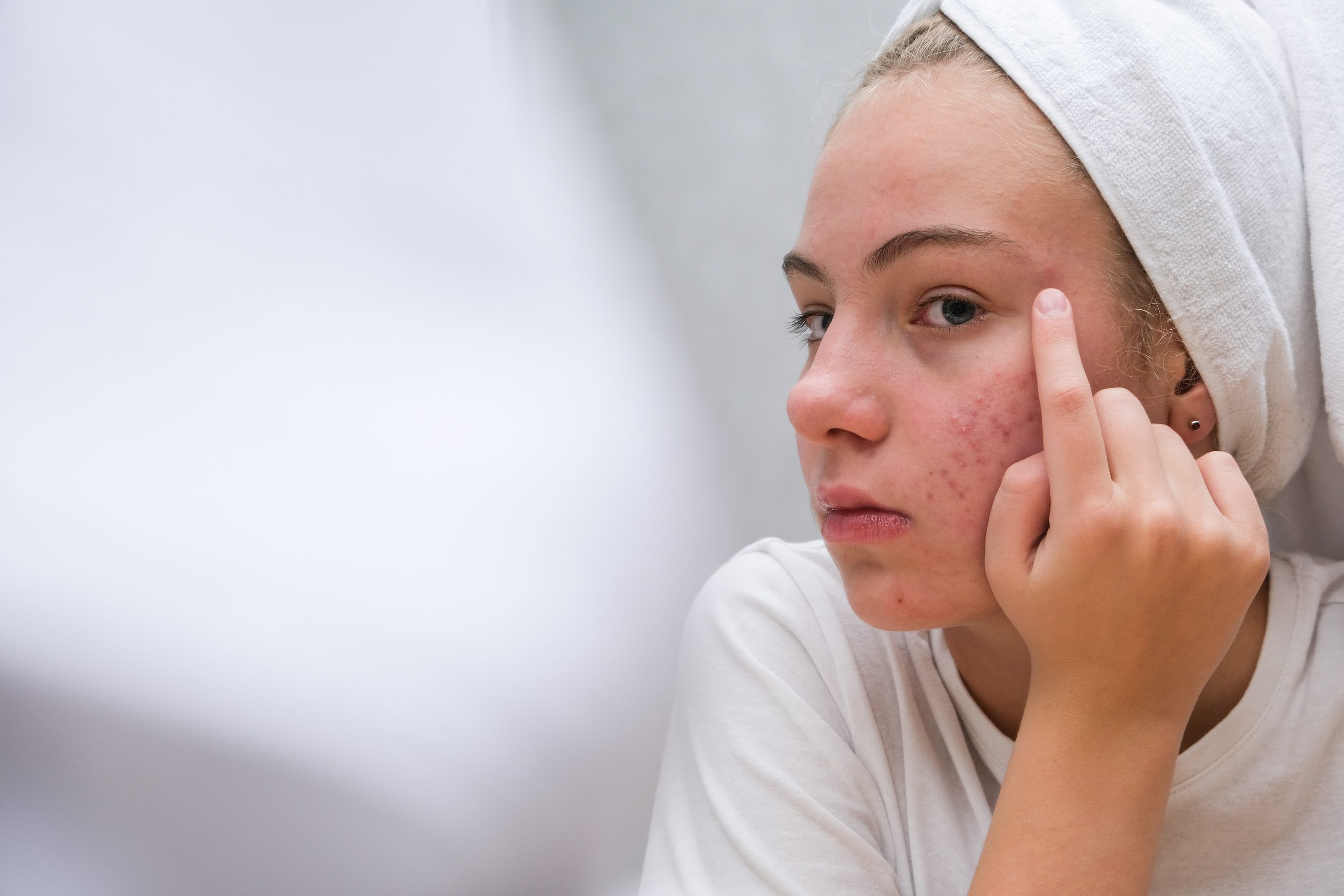 Best Treatment for Pigmentation Cost