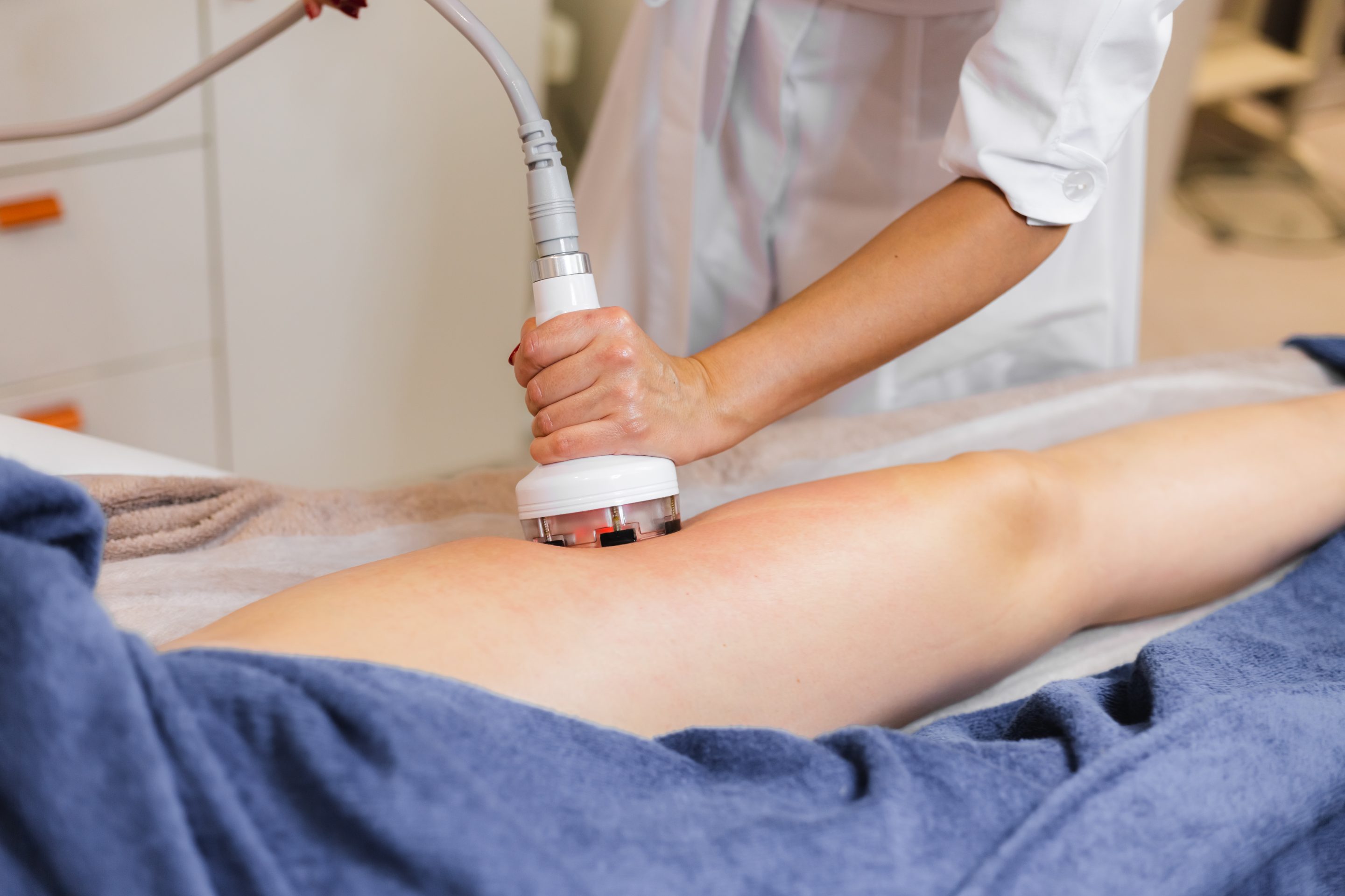 Stretch Mark Removal Treatment cost