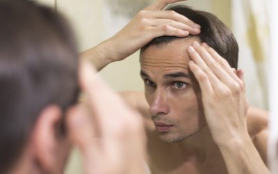 Hair Transplant: Expectation, Recovery, Risk, and Cost