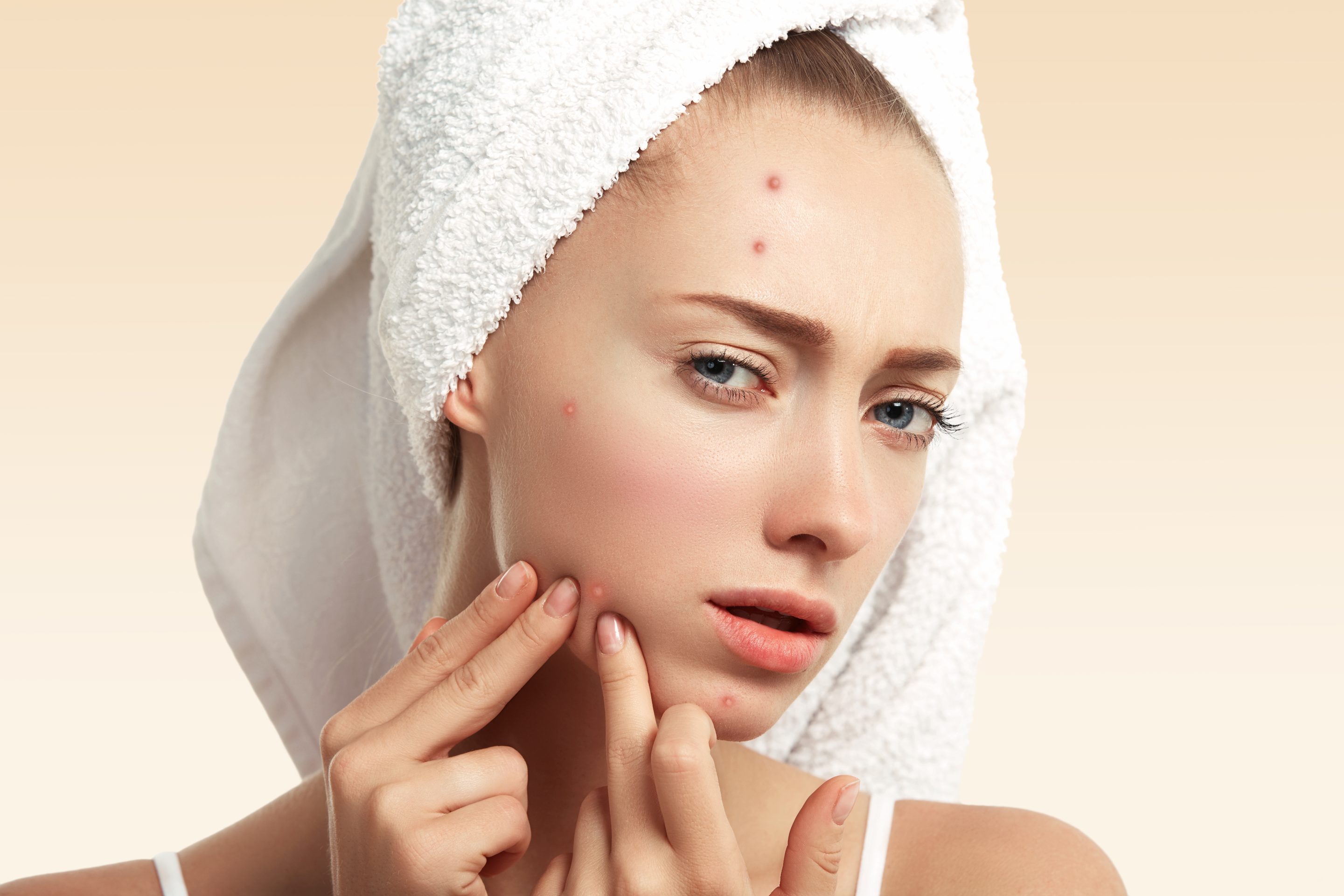 Process of  Acne Scar Surgery 